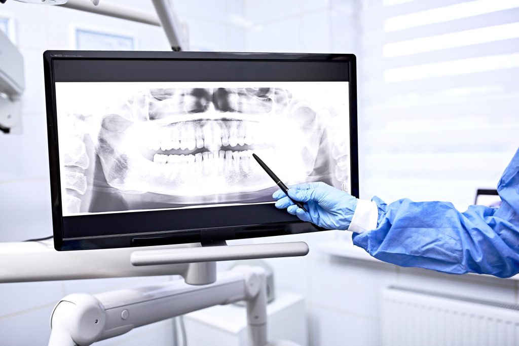 Dentist pointing to a dental X-ray.